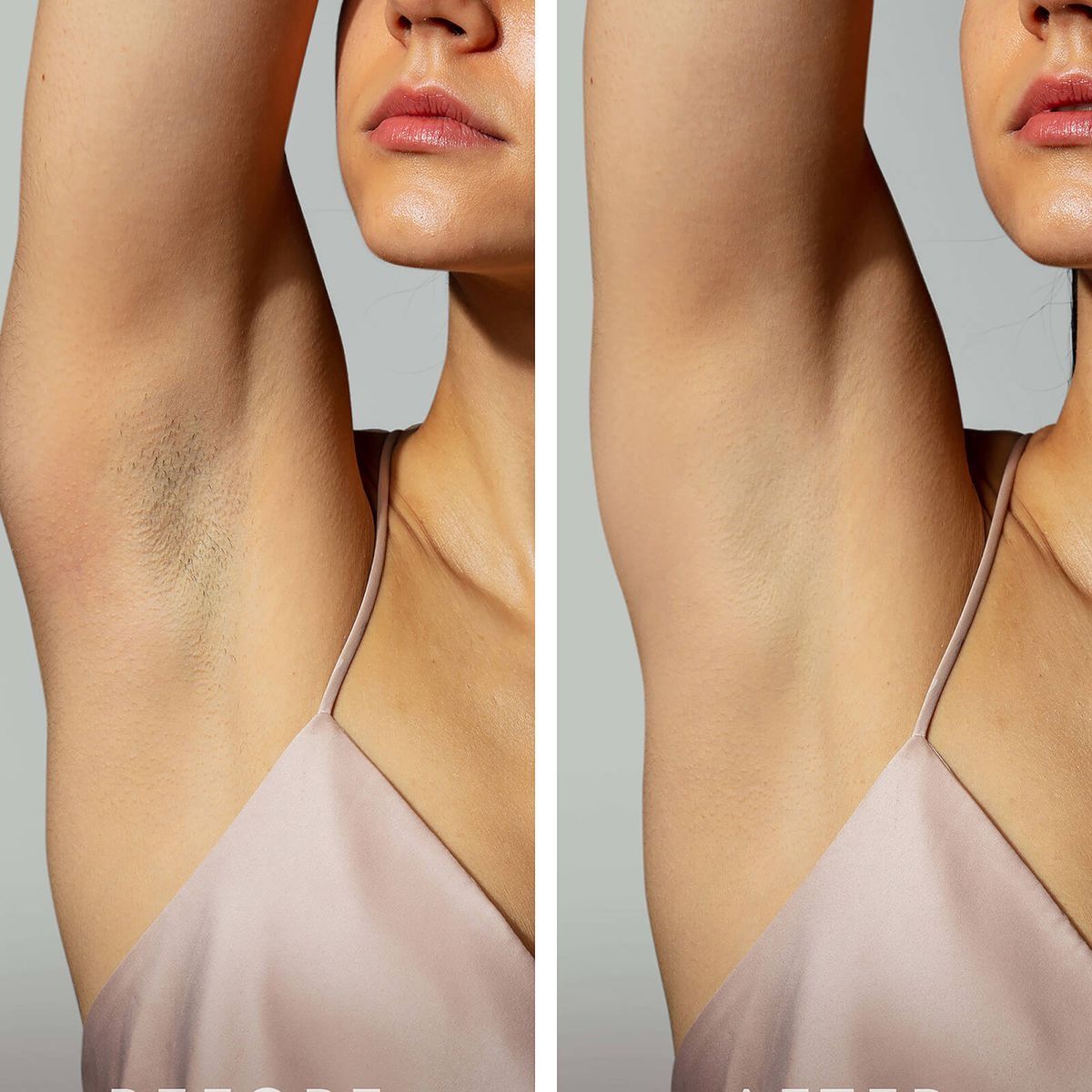 BOLISSI IPL szőrtelenítő