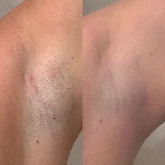 <h2>Beszéljenek rólunk a vásárlóink</h2>