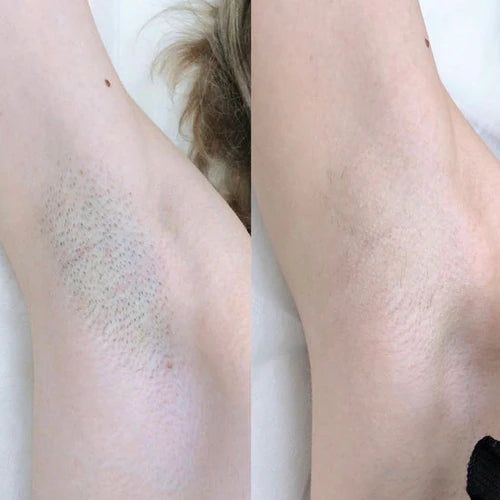 <h2>Beszéljenek rólunk a vásárlóink</h2>