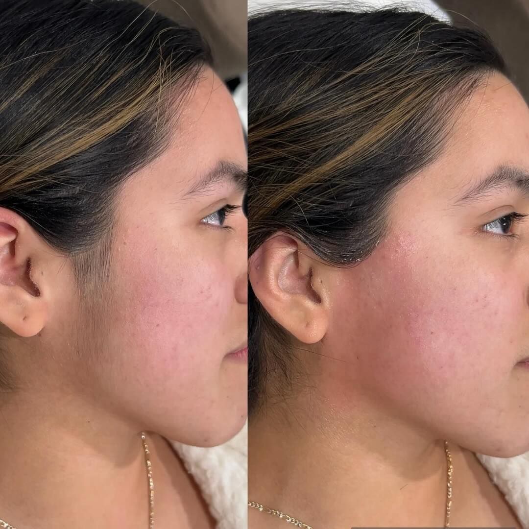 BOLISSI IPL szőrtelenítő