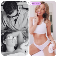 BOLISSI IPL szőrtelenítő