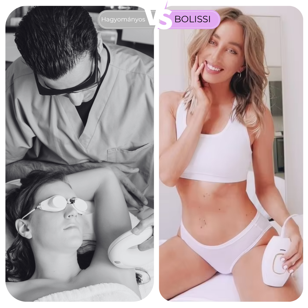 BOLISSI IPL szőrtelenítő