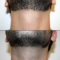 BOLISSI IPL szőrtelenítő