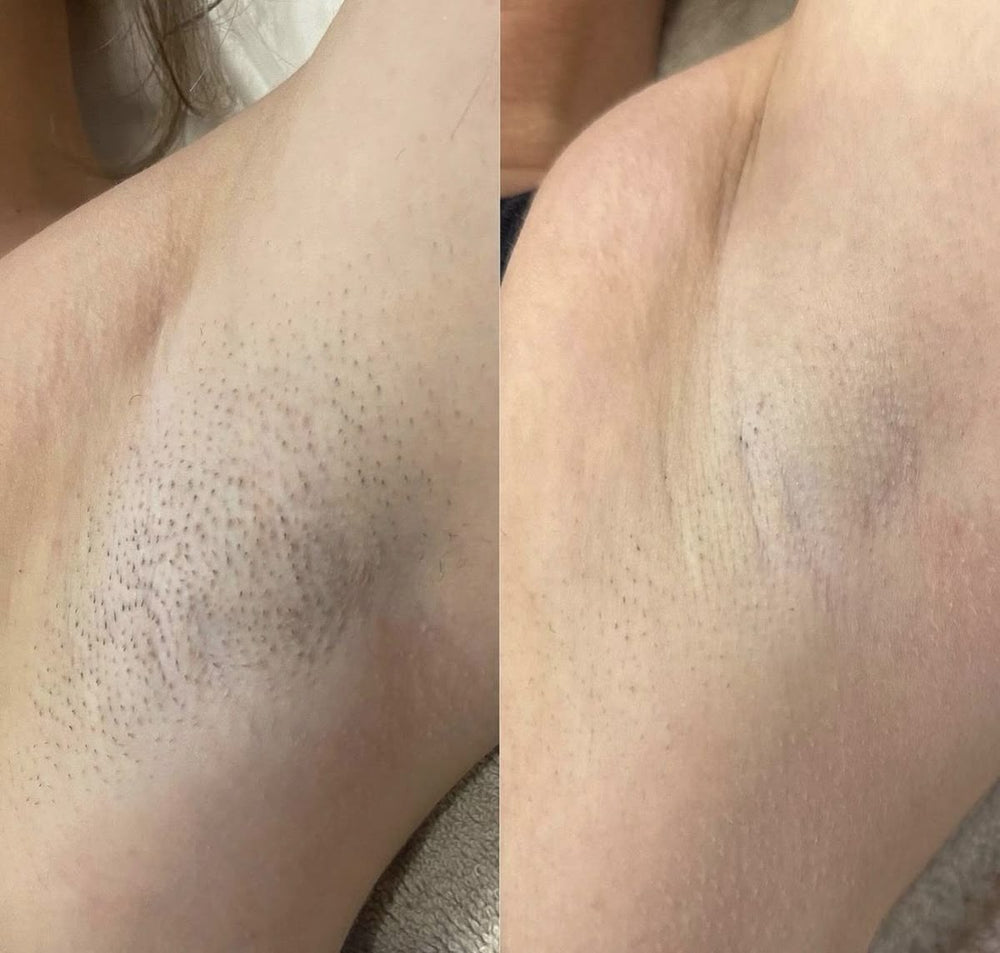 <h2>Beszéljenek rólunk a vásárlóink</h2>